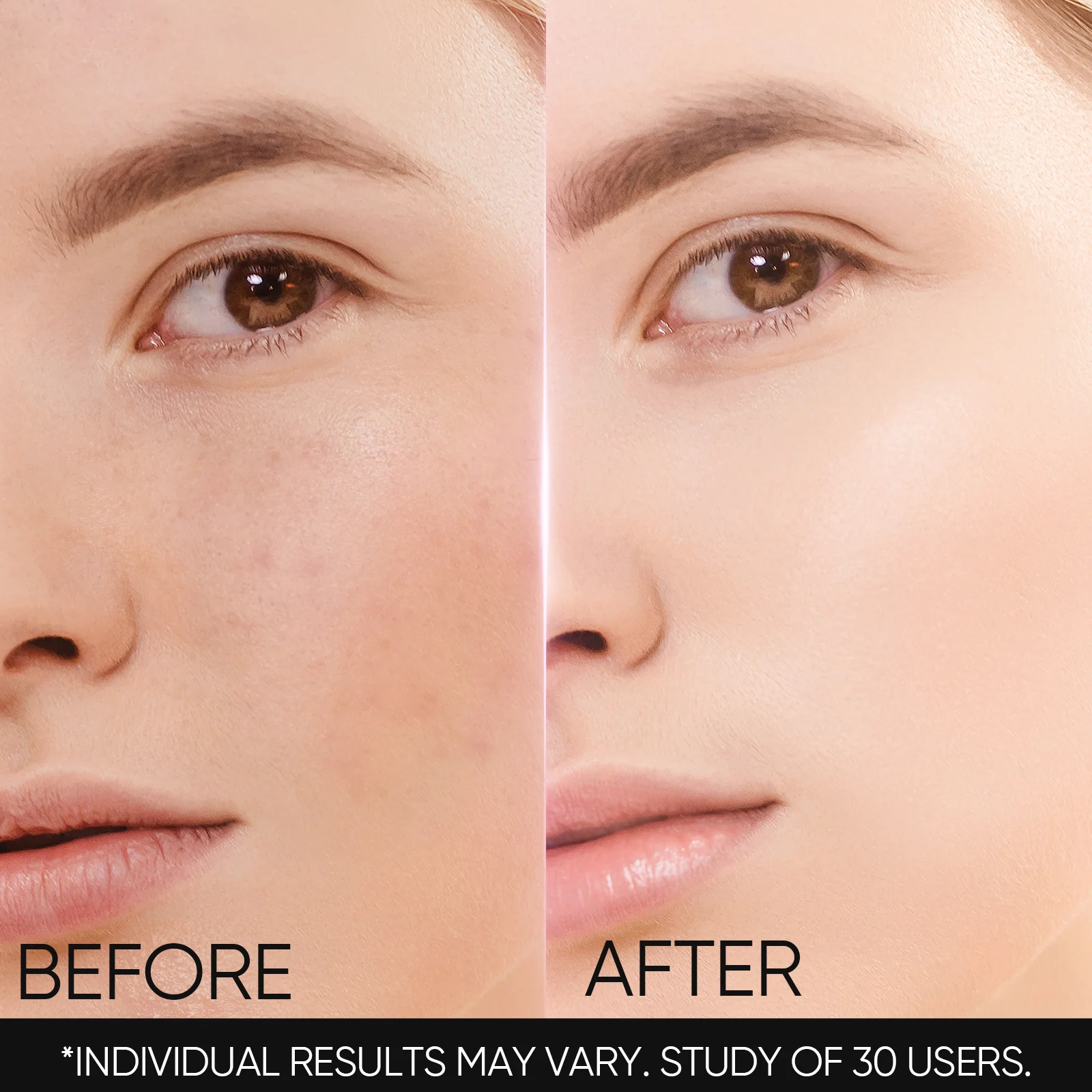 Niacinamide Brightening Set - Image 3