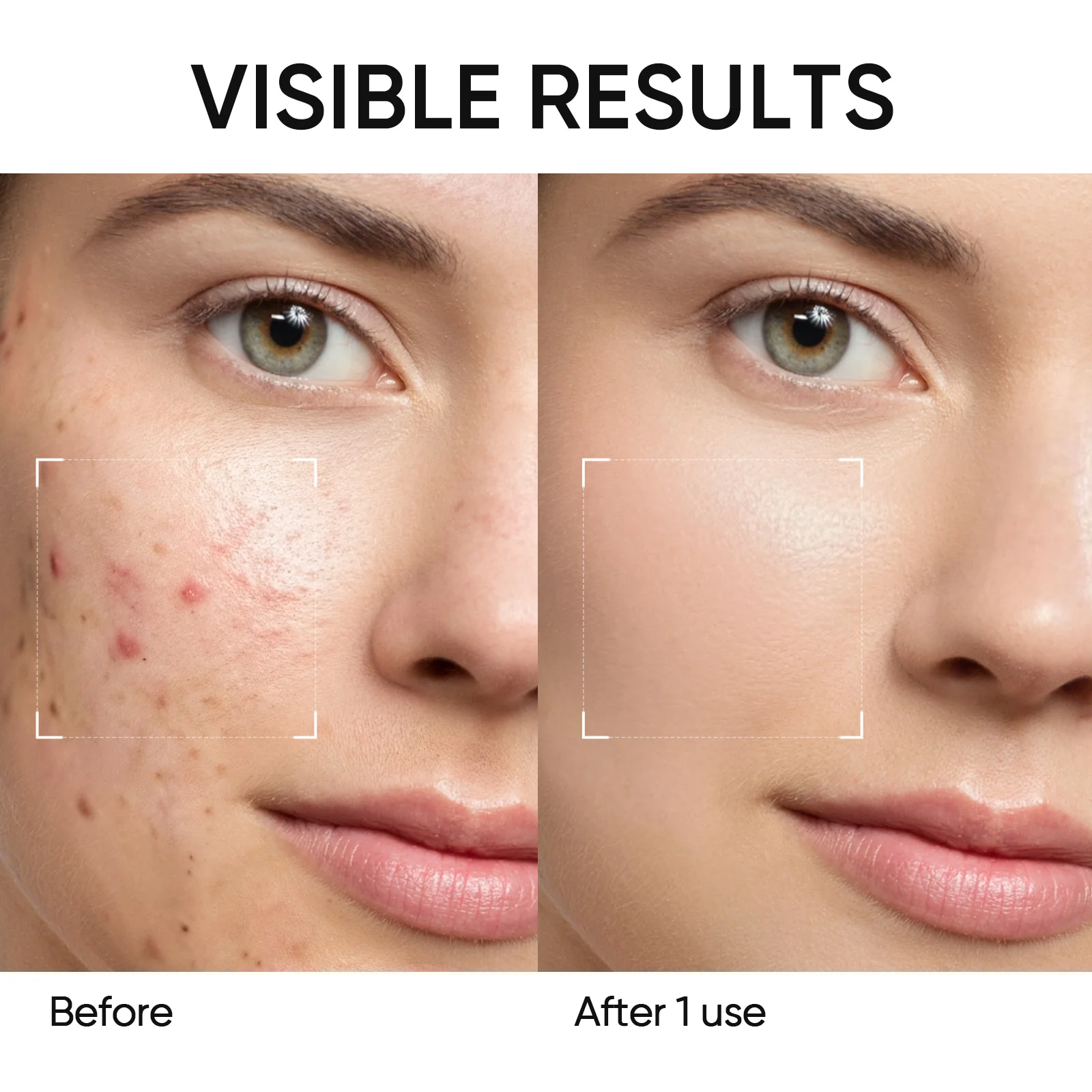 Mugwort Anti Pores & Acne Clay Mask Stick - Image 5
