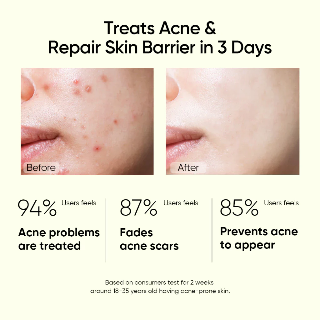 2% Salicylic Acid Serum Acne Treatment & Pore Clearing - Image 2